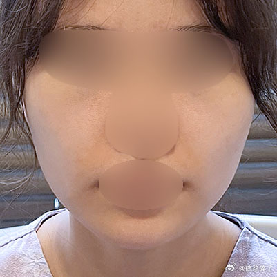 韩网上很牛的一院长，院长之前在《PRS》这项全球整形外科最权威的绿皮杂志发布过论