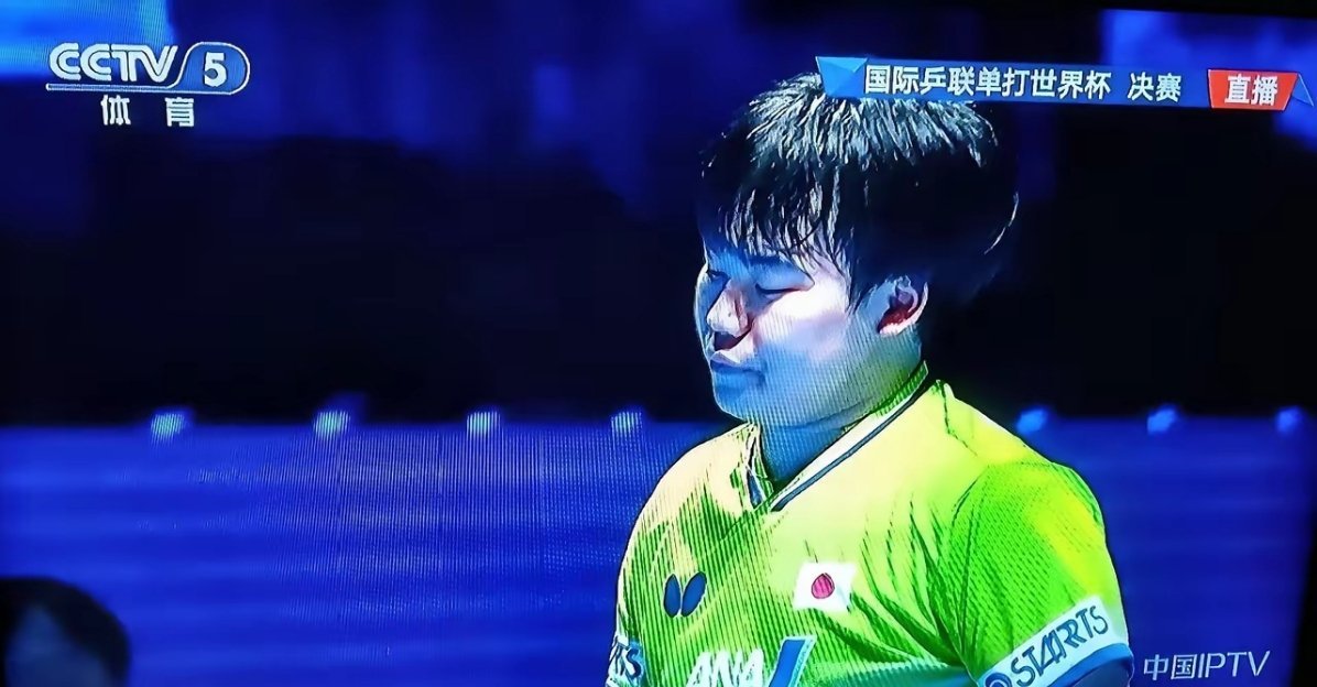 松岛辉空，输了球丑态百出，咬牙切齿，恨之入骨。领奖时拒绝跟冠军握手，合影时还故意