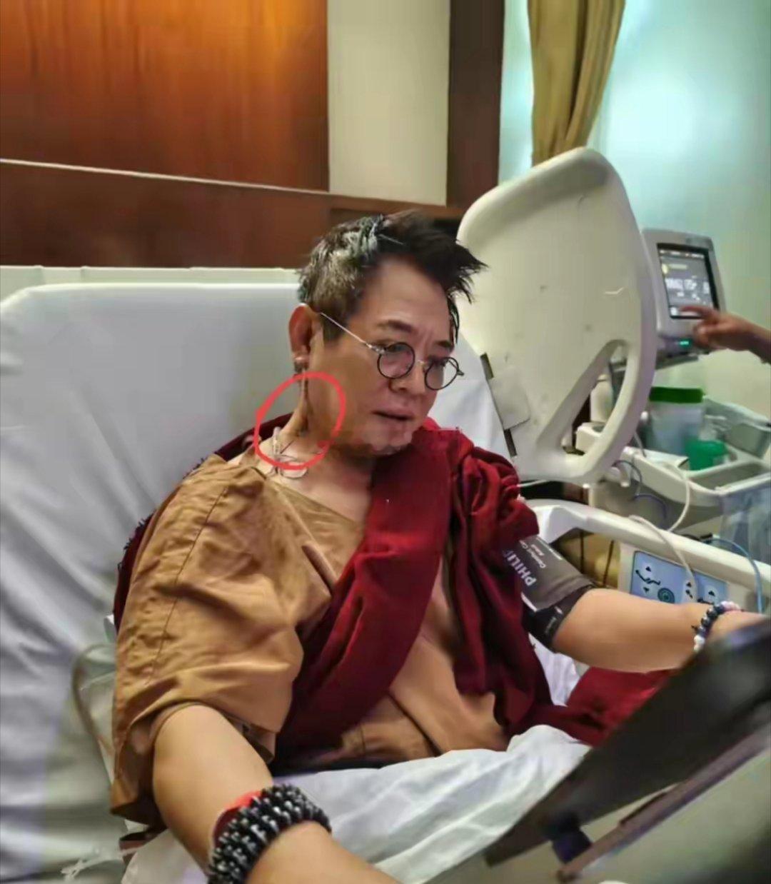 8月17日，李连杰晒自己在病房的照片引发了网友们的担忧，纷纷猜测他到底得了什么病