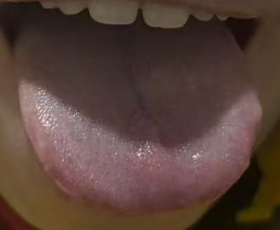 固摄失司？中医辨证调理改善






有不少中老年朋友经常会遇到这样的问题:虽