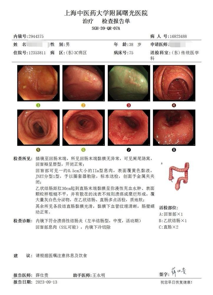 激素依赖的溃疡性结肠炎病人治是有难度的。我们定义，激素停药3个月或者3个月内不能减少到2粒彻底控制症状，就是属于激素依赖。
反复使用激素的患者，包括激素灌肠，都是属于激素依赖。
激素依赖以后，溃结仍然反复发作，很多药物用上去反应都不会好，包括单抗，也包括有效的中药，我们叫做没有应答。所以不到万不得已，不能反复多轮使用激素。