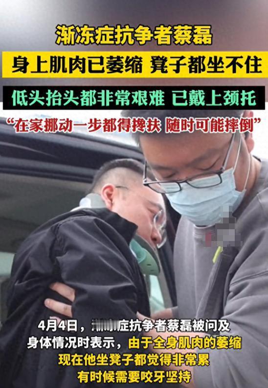 蔡磊被渐冻症折磨到晚期，舌头嘴唇萎缩，洗澡靠绳子悬吊稳住身体！

北京，蔡磊跟渐