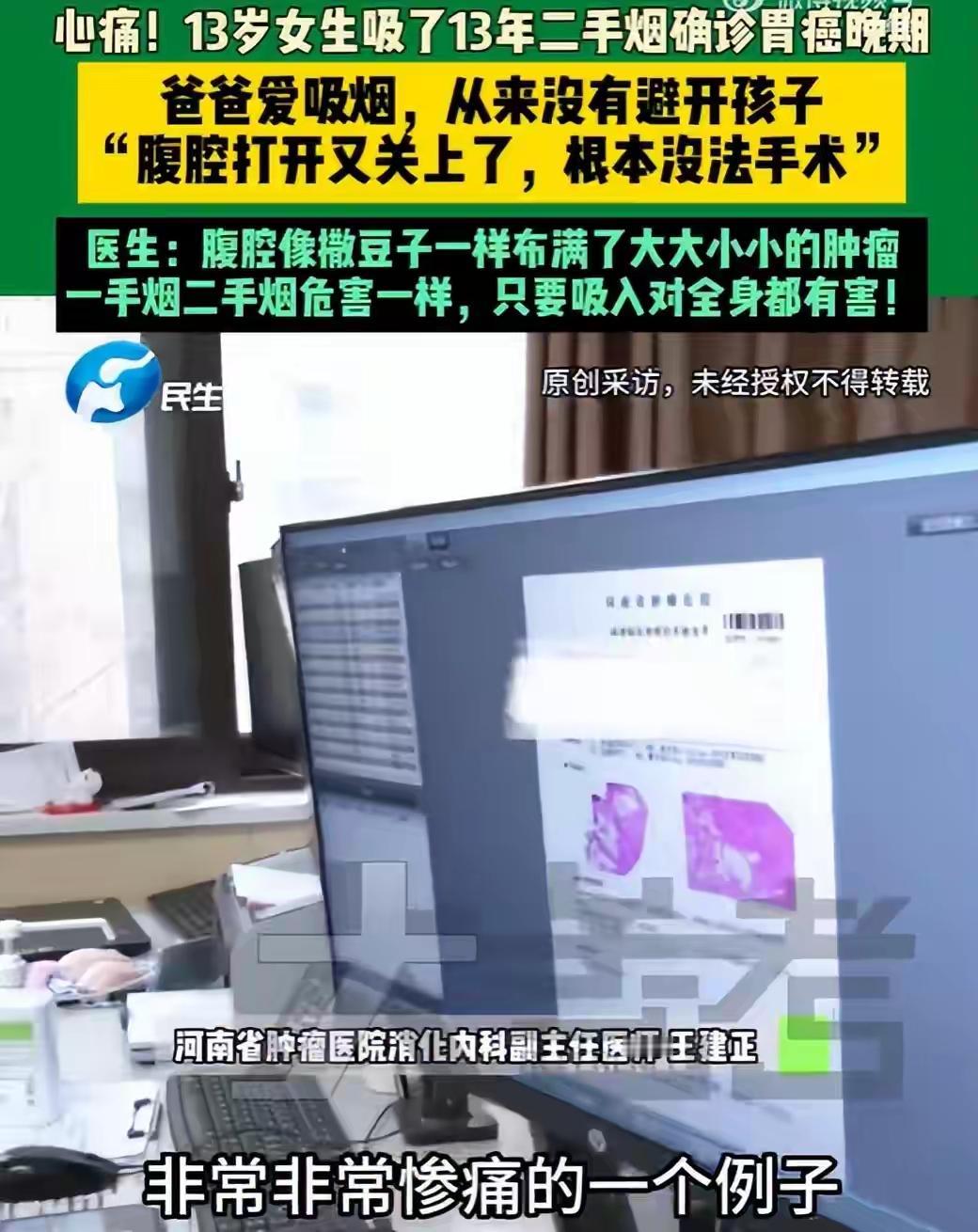 震惊！13岁女孩被确诊晚期胃癌，父亲吸烟多年竟成祸根，医生：无药可治，生命垂危！