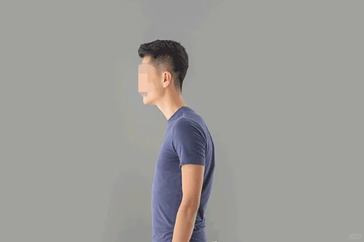 驼背的人图片