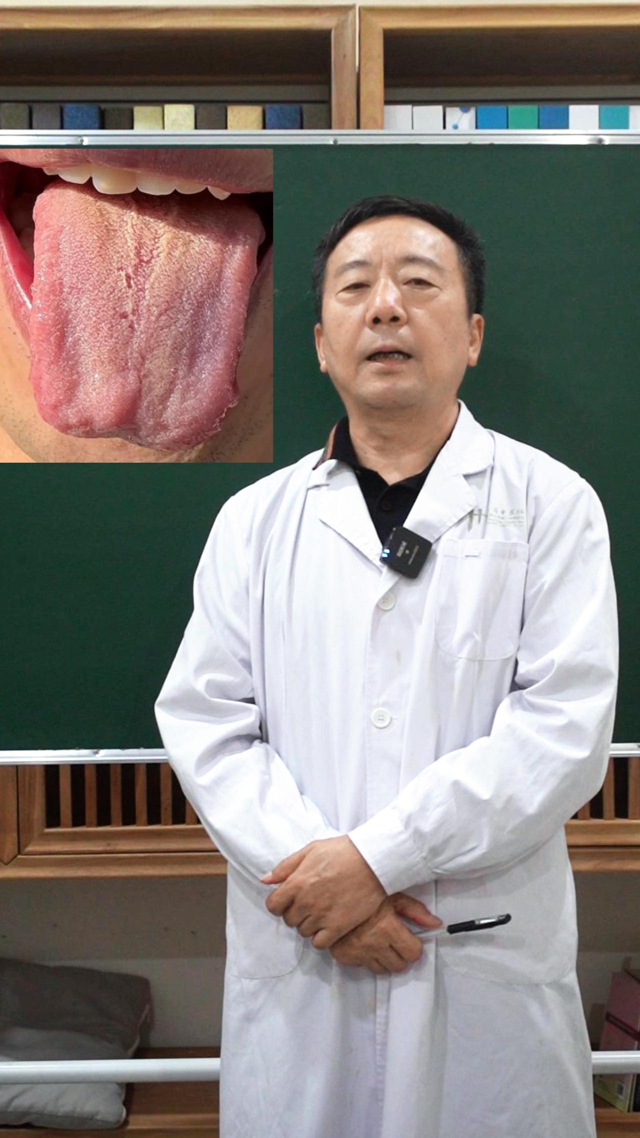 朋友们，大家好啊，今天是舌诊挑战13天。
最近看舌头的朋友，越来越多了。
挑战一