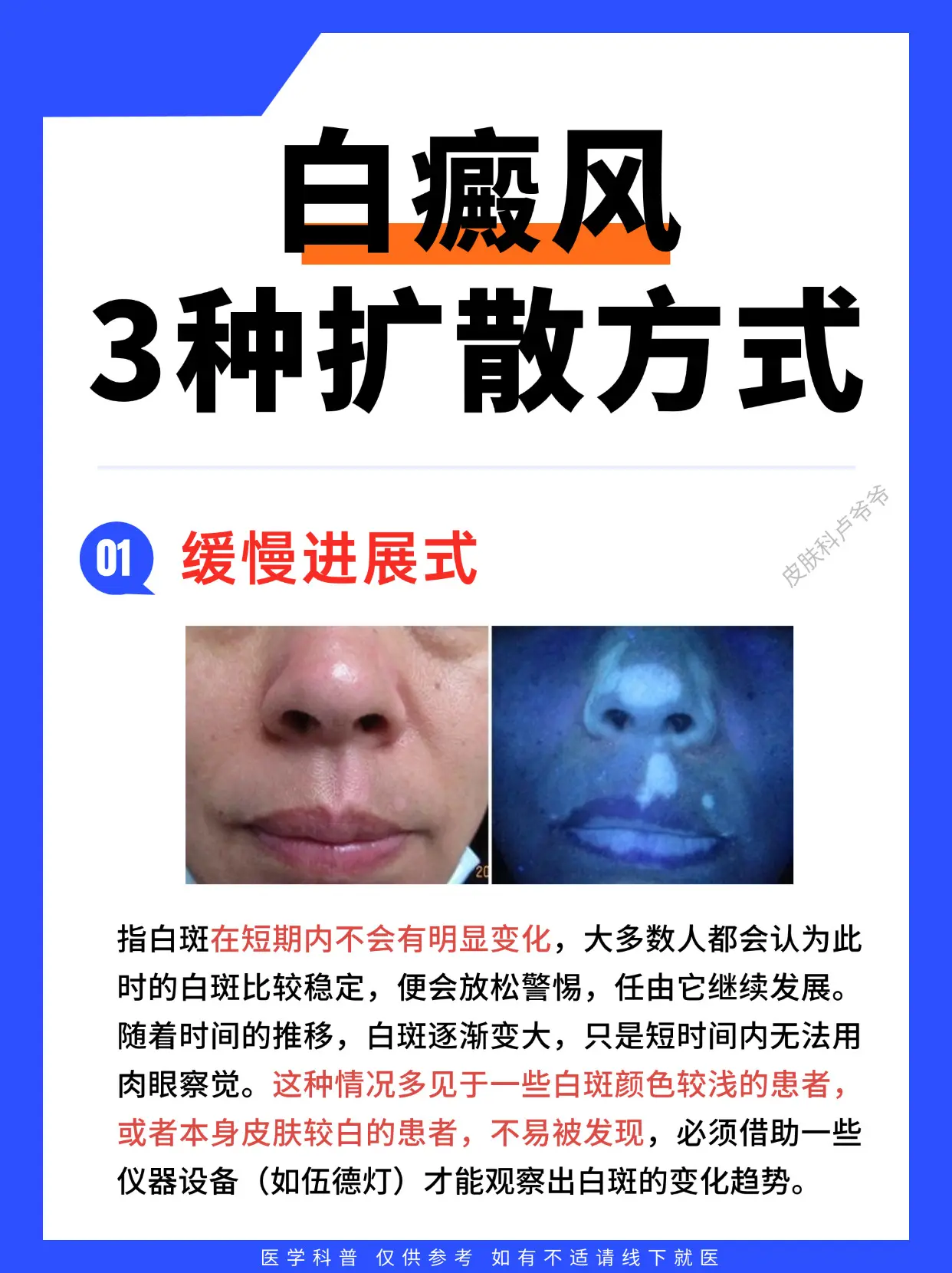 医学科普 白癜风 白癜风科普 硬核健康科普行动 医疗健康创作训练营