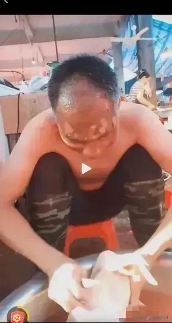 我们以为，男人被妻子用开水烫以后，会去医院治疗，会和妻子去民政局离婚，回去法院告