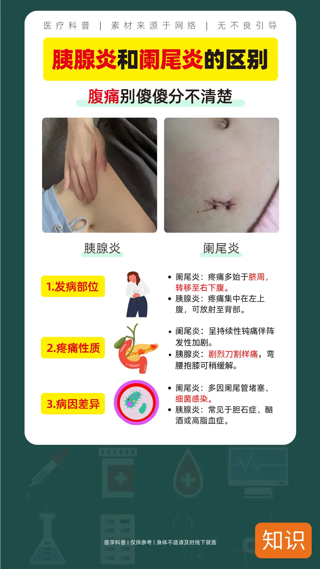 胰腺炎和阑尾炎的区别，别傻傻分不清楚，收藏起来。