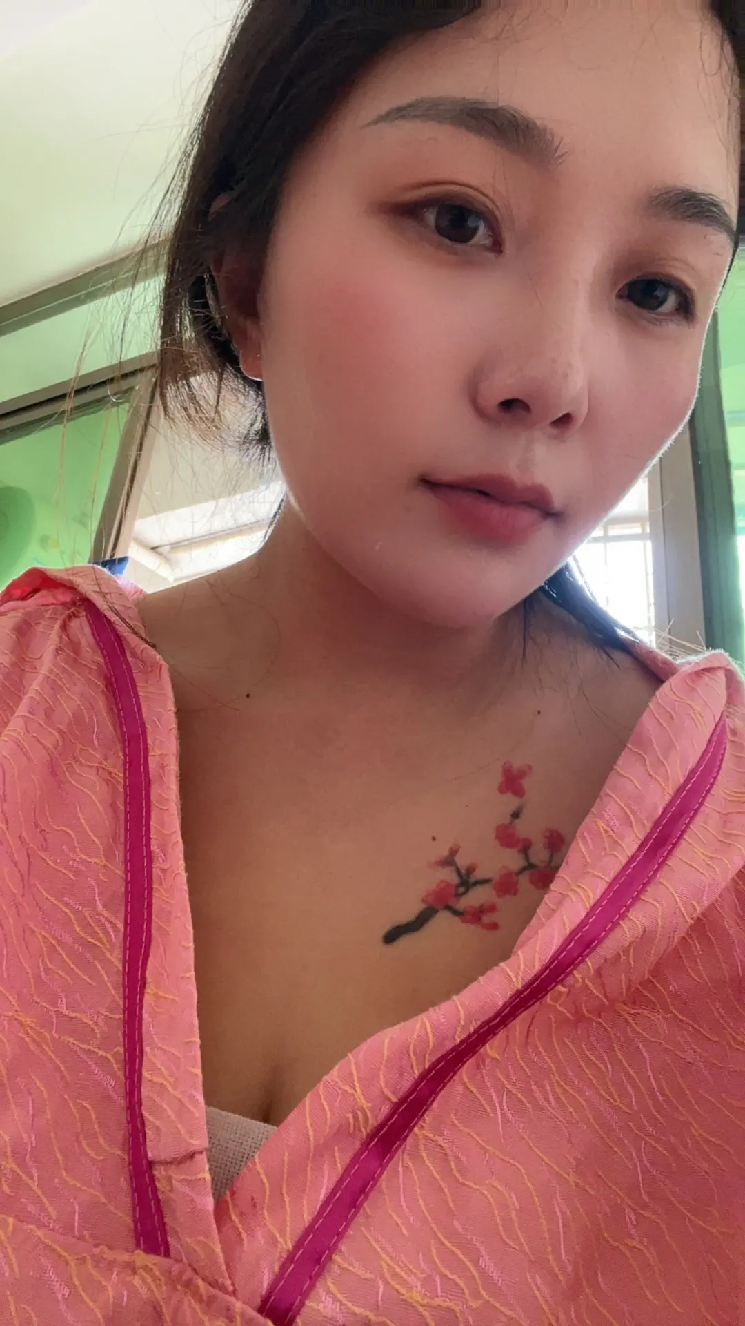 一个星期终于拆绷带了，现在贴着纱布过三天，应该可以不贴纱布了，自由了