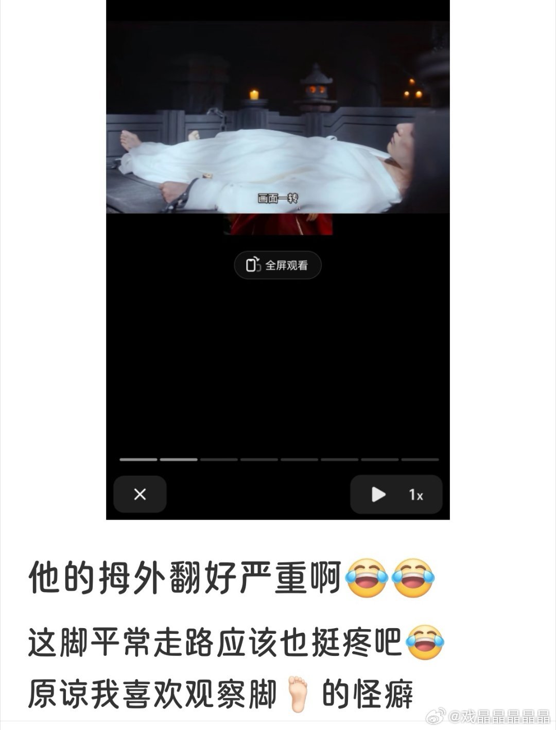 一般女孩子经常穿高跟鞋的才会拇指外翻，男生很少这种毛病 