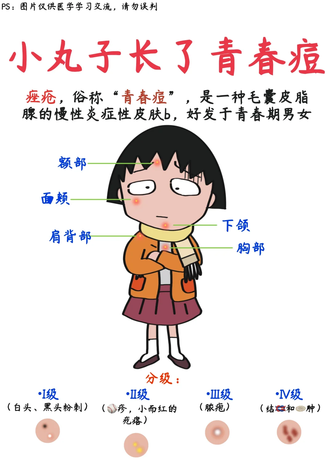 📒看漫画轻松学｜青春痘自救指南 ✅干货收藏