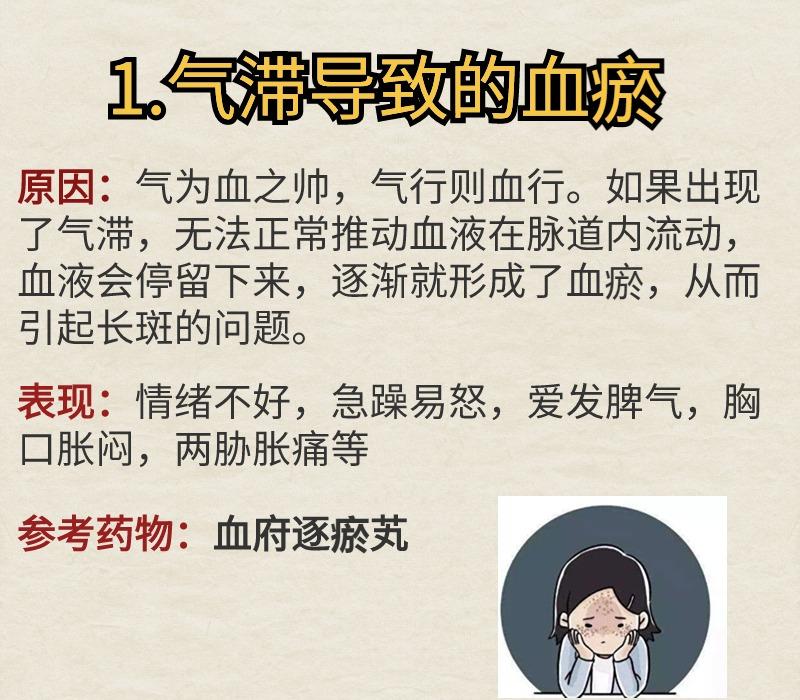 脸上长斑是瘀血所致，那么如何活血化瘀？恢复你的美丽容颜，这四个中成药，一步到位。
