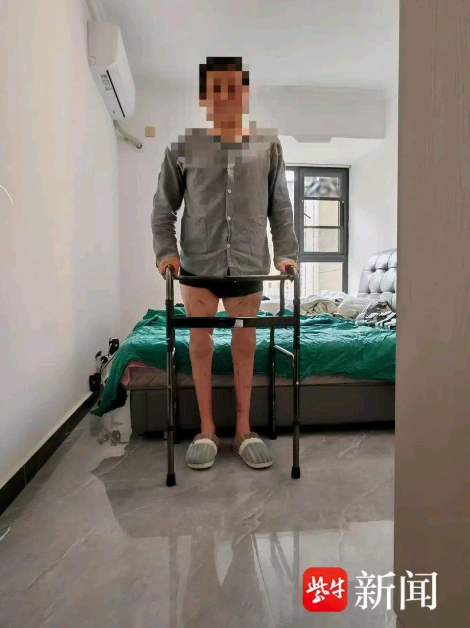 这简直就是个奇迹！双腿被机器绞断，这得承受多大的痛苦啊。近20个月的时间，他得付