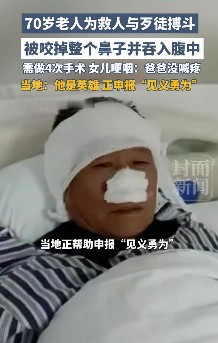 给这位大爷鼓掌吧！70岁老人为了救人与歹徒搏斗，结果鼻子被对方咬掉吞进肚里！需要