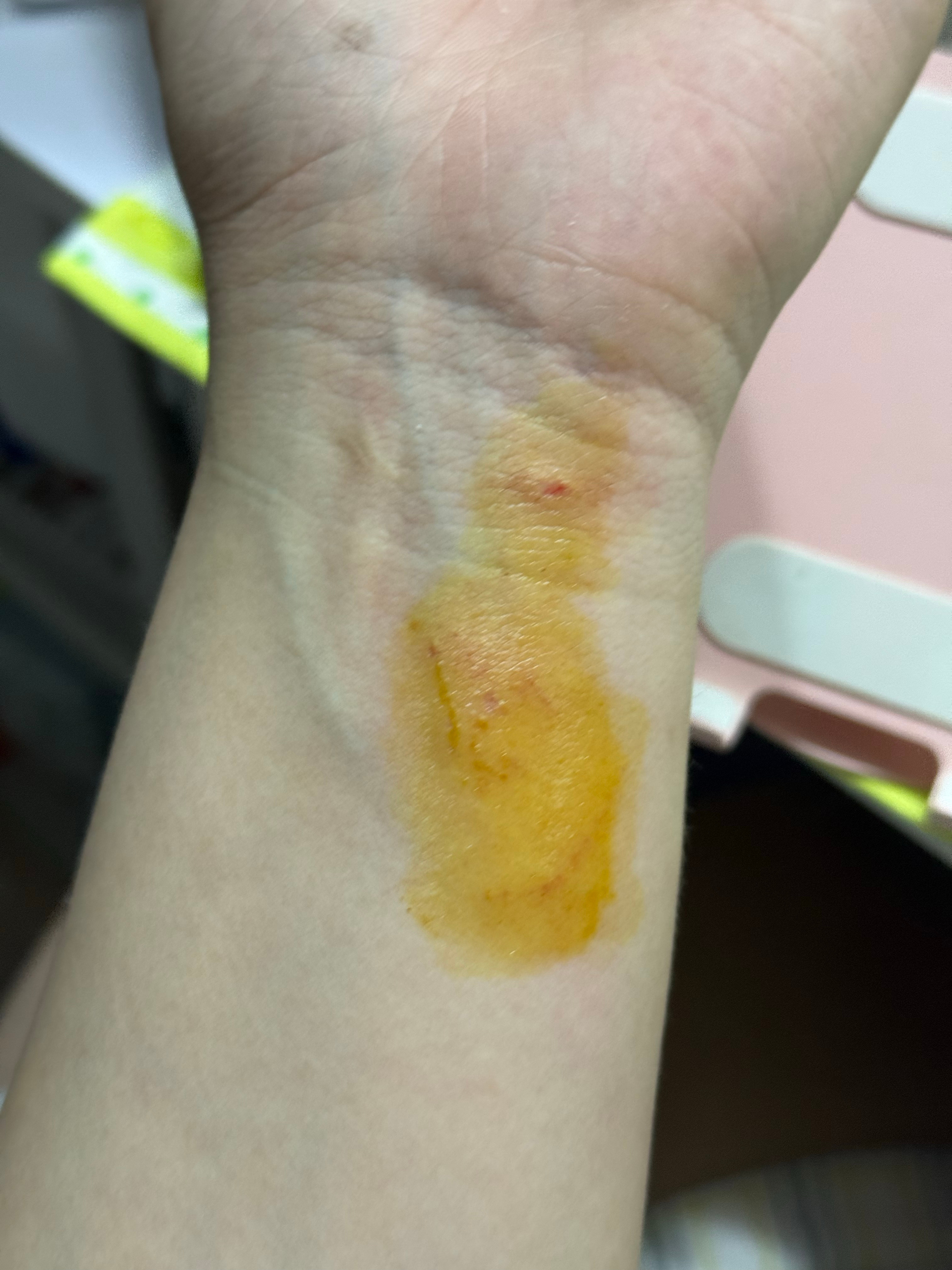 被旧洞洞鞋害了，早就该扔了
