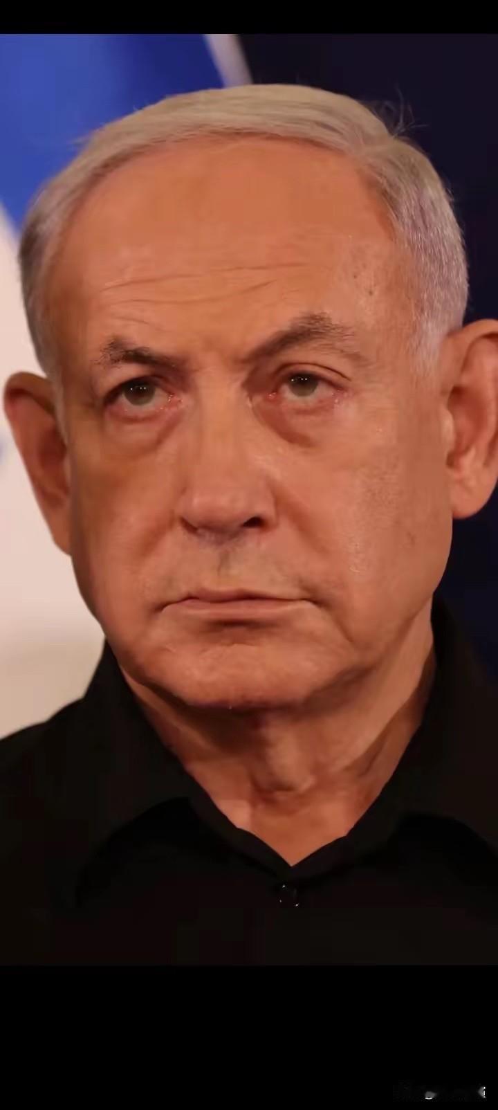 内塔尼亚胡双手沾满鲜血，是不折不扣的战争贩子

长久以来的冲突，让普通百姓承受了