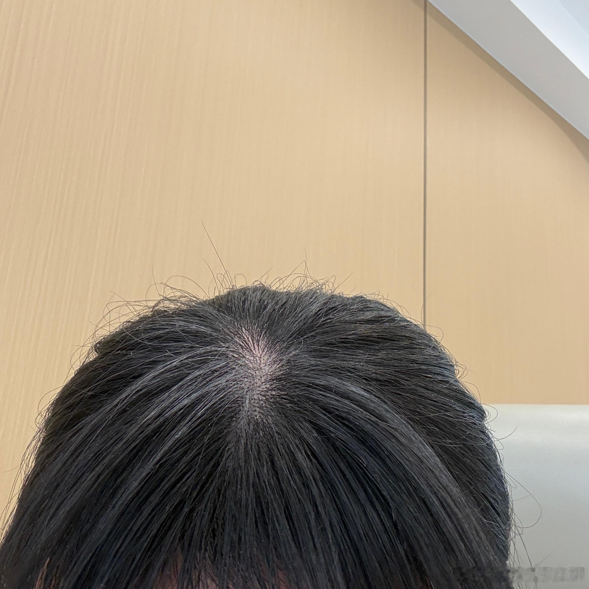 诗裴丝你真的能让我丢人丢到大西北。我同事：你头发咋了？我：啊？我同事：你快看看。