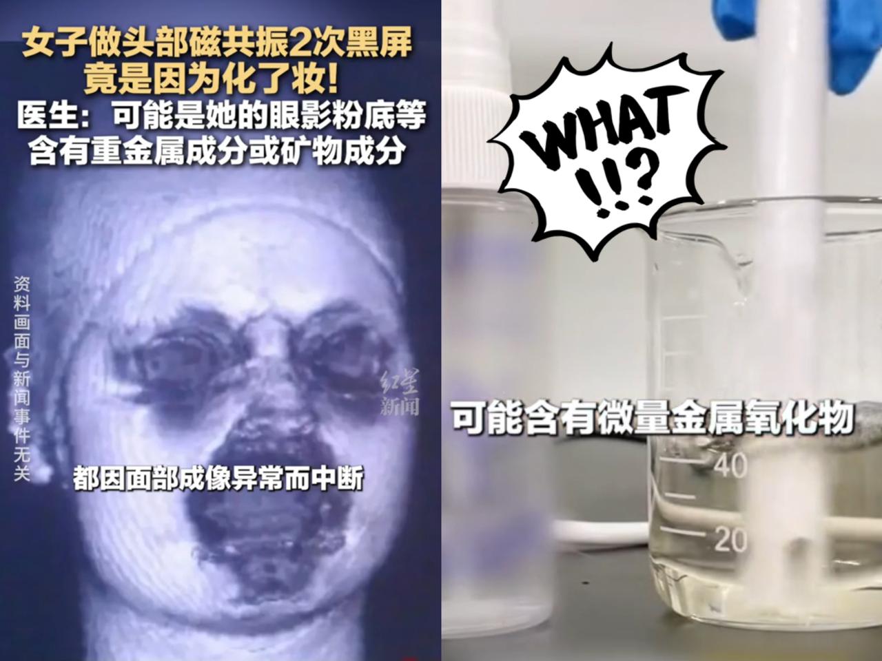 这事儿真是解释不清了！
福建一29岁女生头晕去做头颅磁共振，
连续2次扫描都
