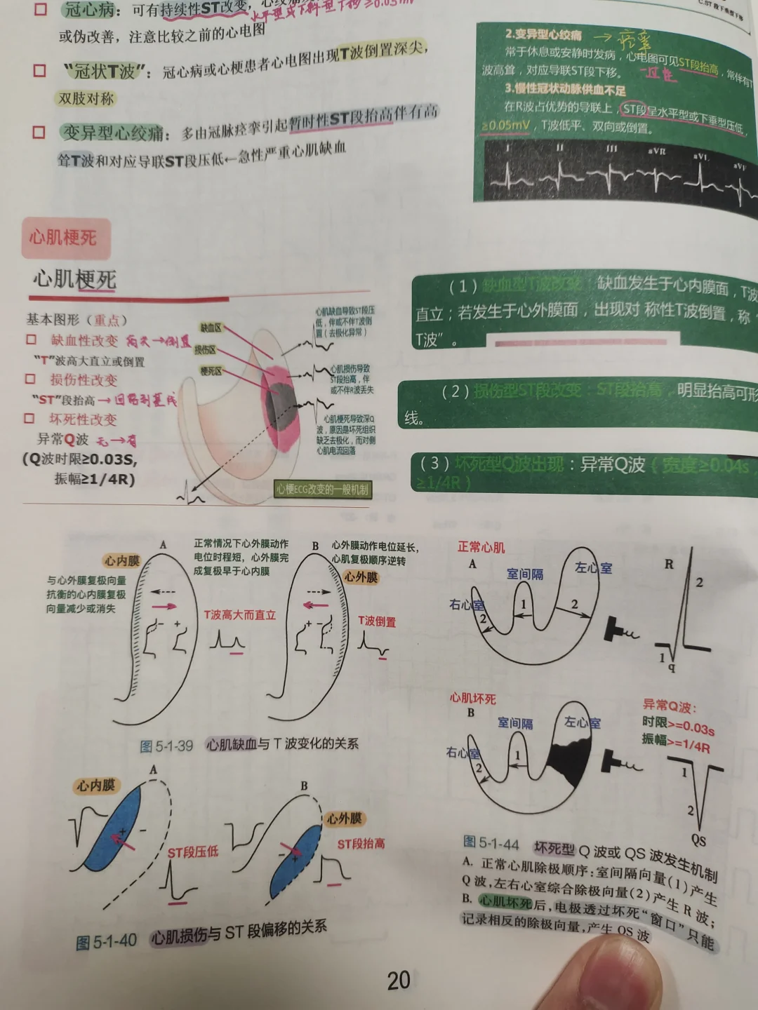 医学生规培心电图学习诊断