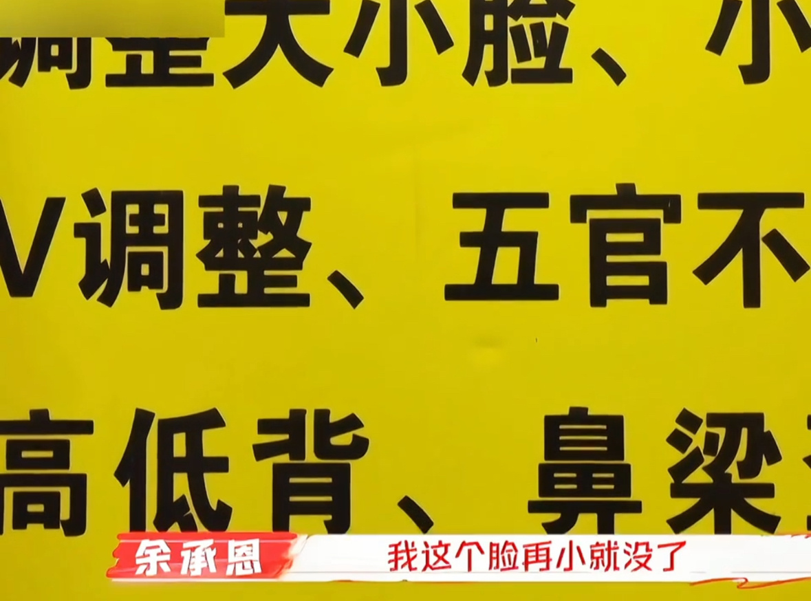 余承恩说自己脸再小就没了 余承恩这是在线演绎“我姐已经三天没打我了！”哈哈哈～笑