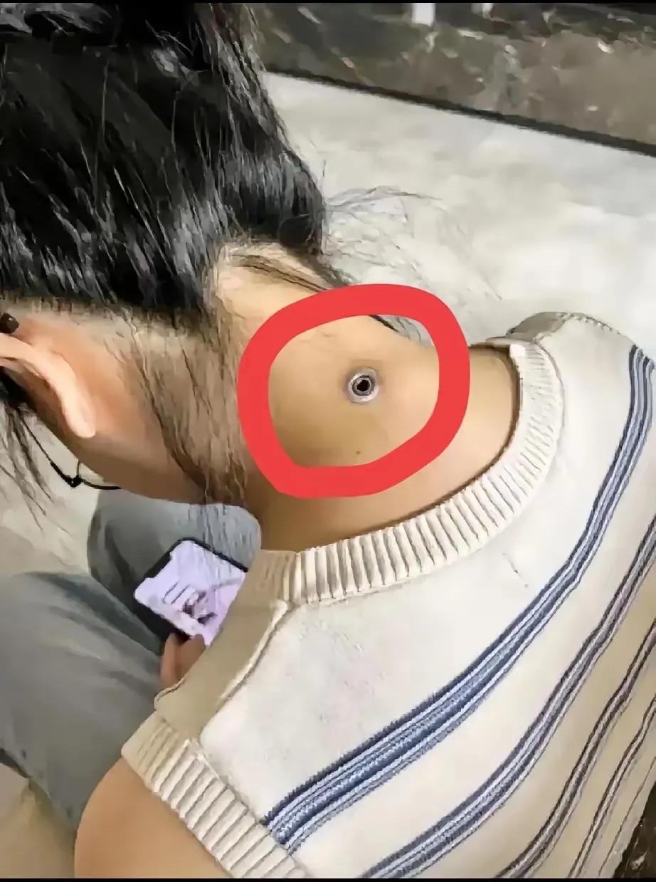 脖子颈背处有插孔，网上看到的，真挺让人摸不着头脑的。最近网上好多人讨论有人从国外
