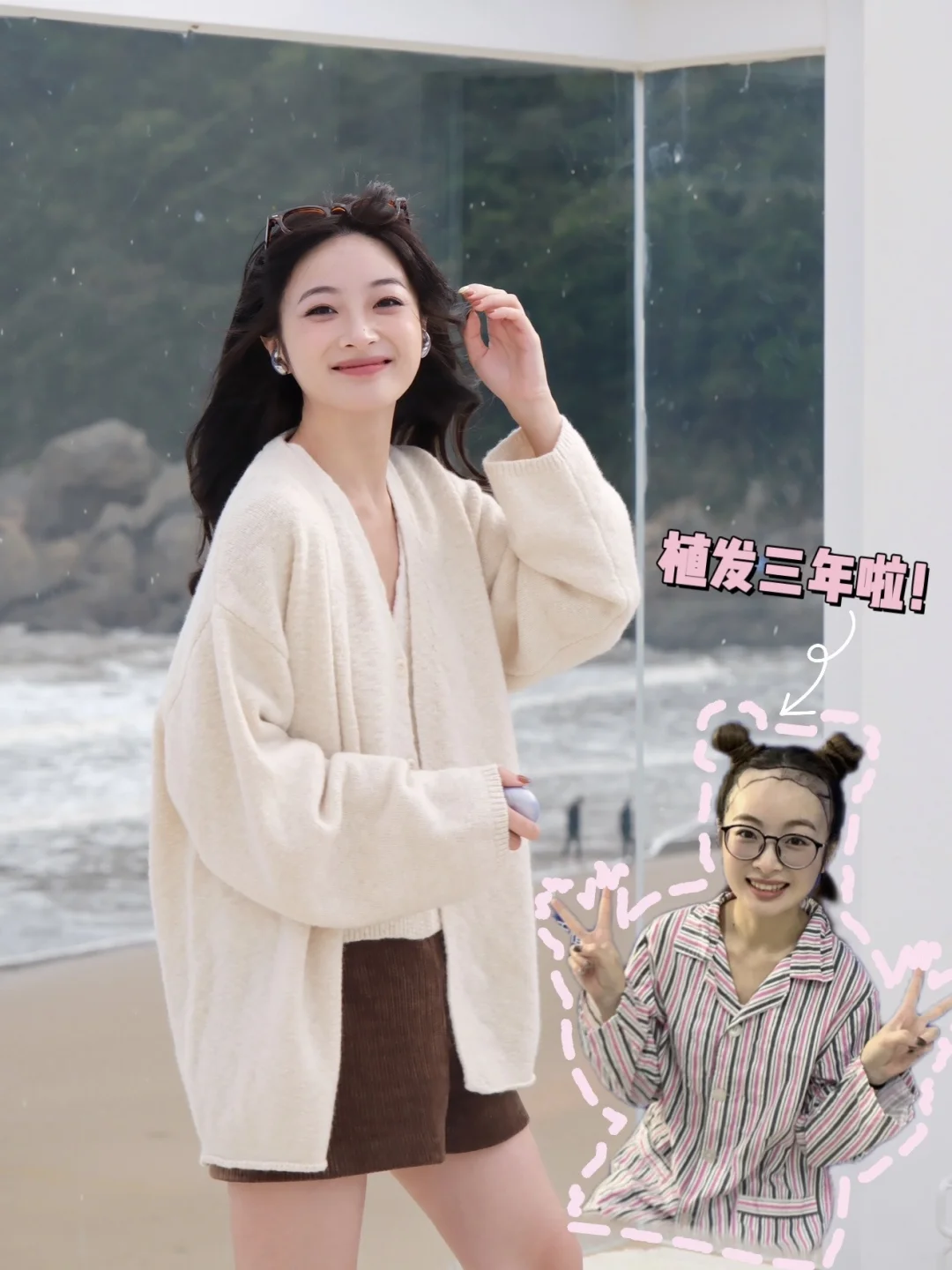 别只盯发际线形状！密度才是自然关键✨