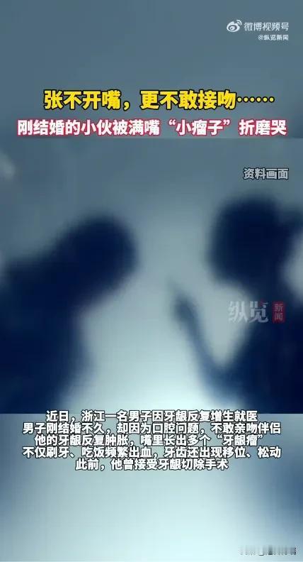 浙江男子刚结婚就有难言之隐，张不开嘴更无法接吻，被满嘴的“小瘤子”折磨哭，医生：