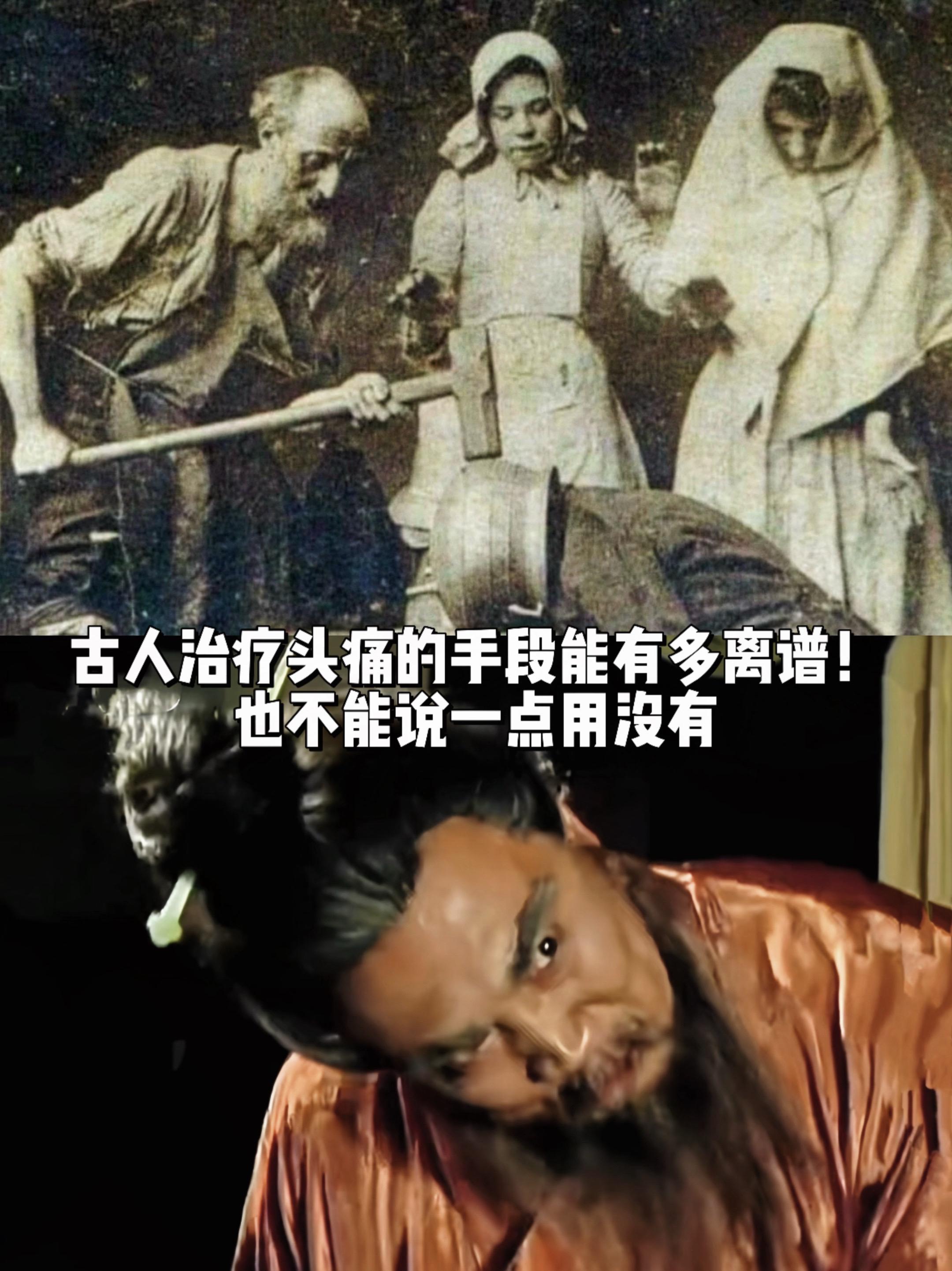 古人治疗头痛的手段简直一个比一个离谱！1895人们将头套在铁罐子里，拿...