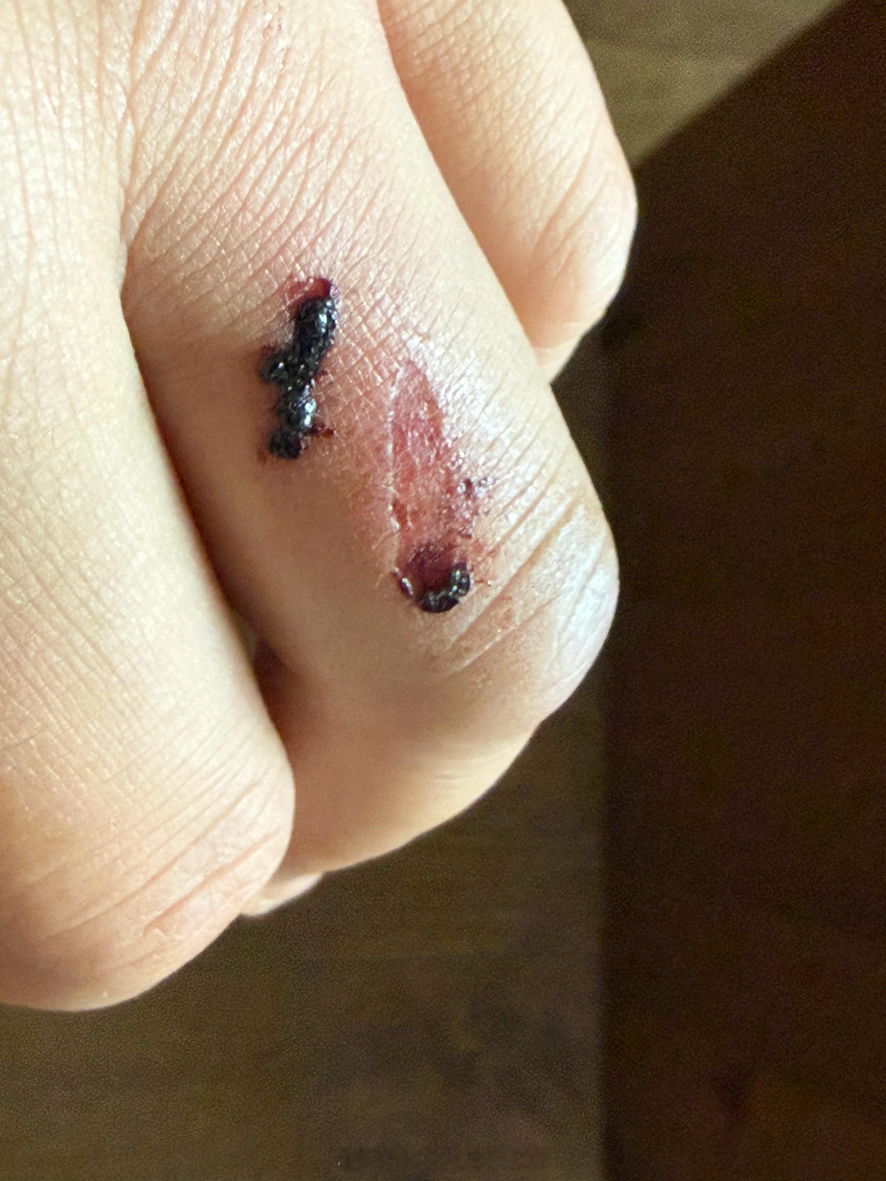 生生的给我铲掉一层皮啊！哎 ​​​