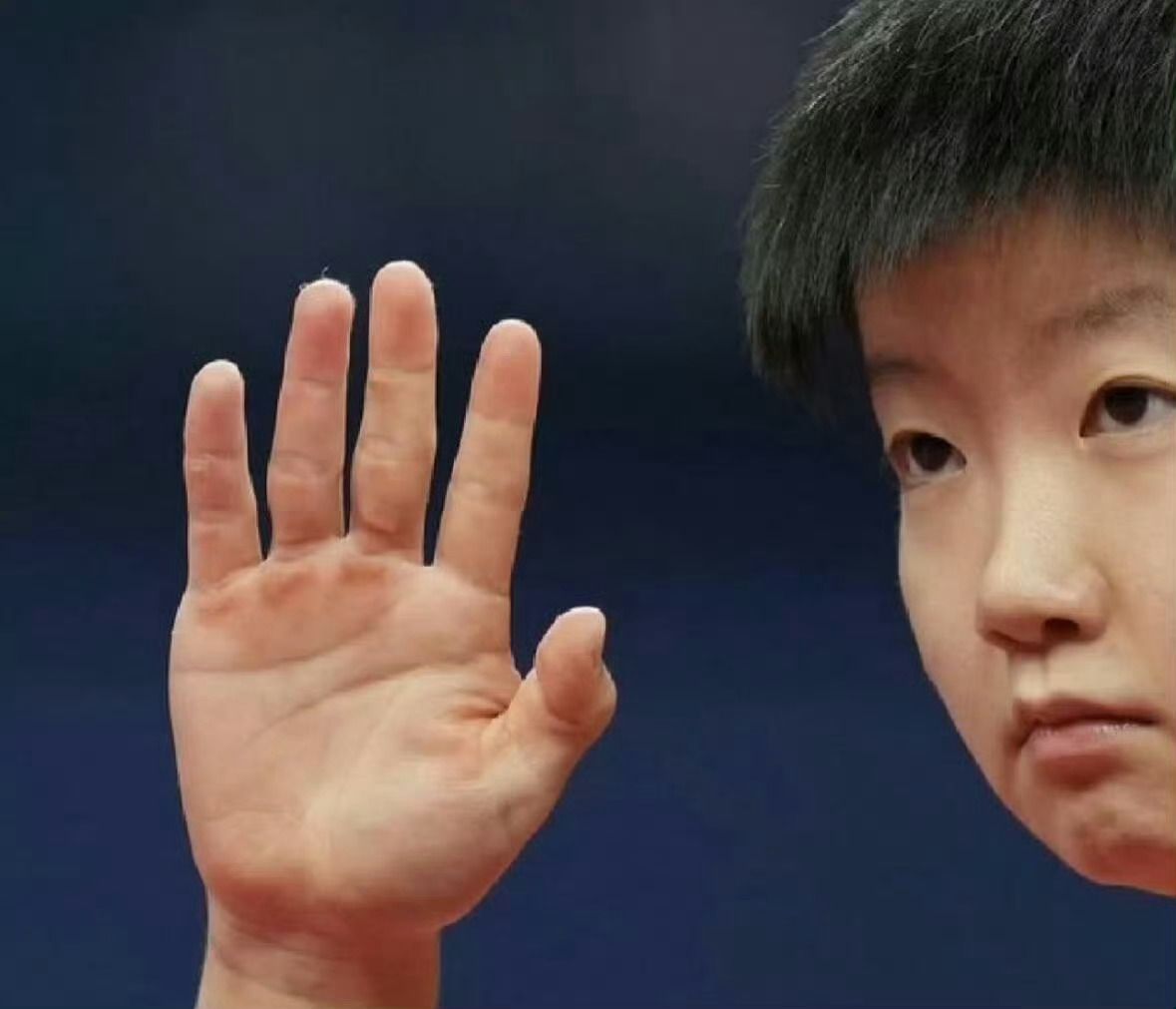 孙颖莎两只手臂的粗细差距双臂粗细的差距，是千万次挥拍刻下的印记，手上老茧、身上淤