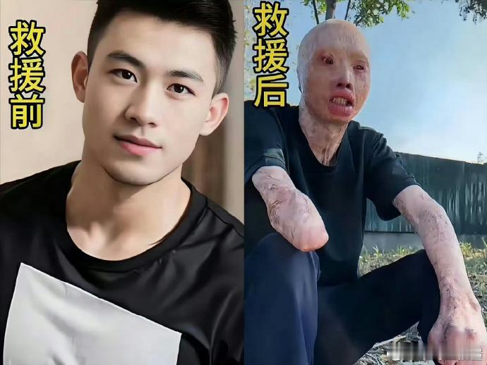 救火英雄救援前后照片，太心疼了！向英雄致敬！！ ​ ​​​