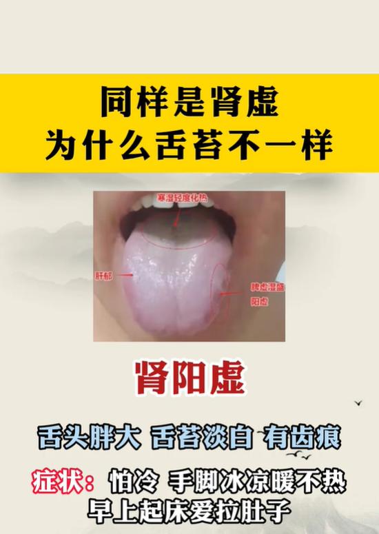 四种肾虚舌象科普：阴虚、阳虚、气虚、肾精亏虚如何区分