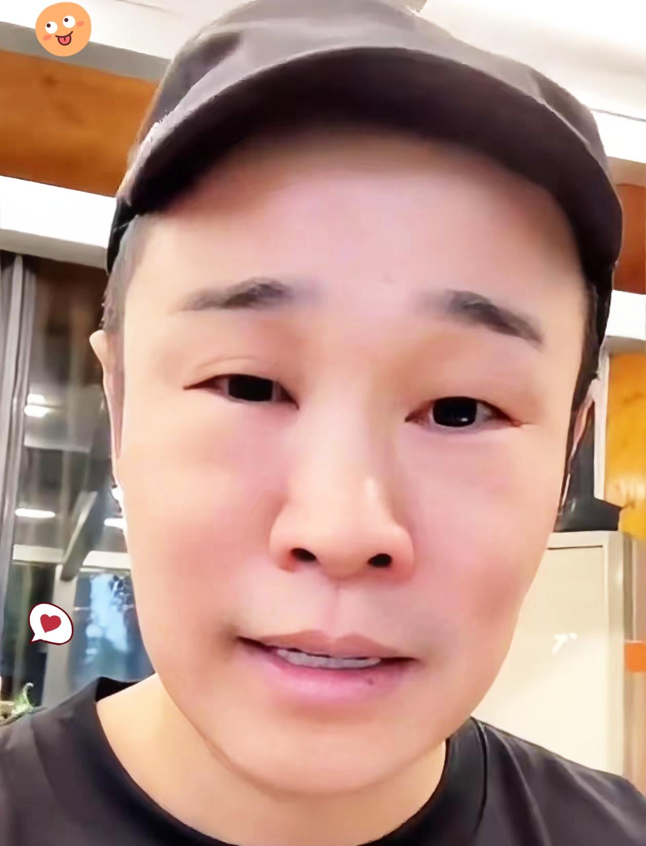 我有个医生朋友看到小沈阳眼肿，说了句大实话，这不是衰老带来的问题，是持续不停的工