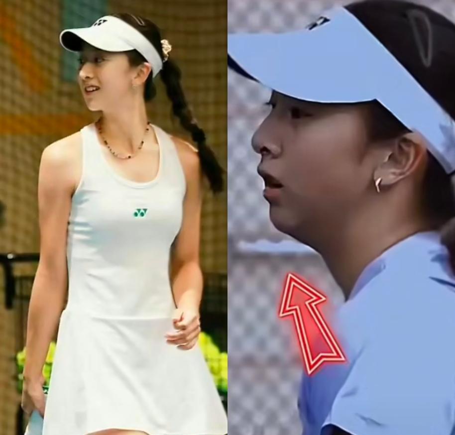 田亮女儿森蝶的牙，覆咬合突然打开了。
网球场边的高清怼脸拍，那截下巴的线条，硬生