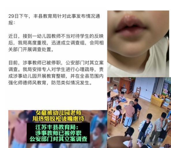 4 岁女孩嘴唇被热熔胶枪烫至溃烂，当地官方通报已发布。这件事曝光后让不少人难以接