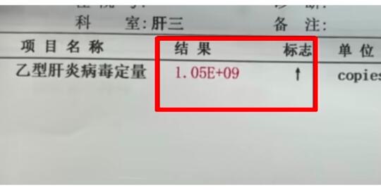 这是一位山东日照大三阳患者的化验单，32岁，乙肝病毒量却高达数十亿！经...