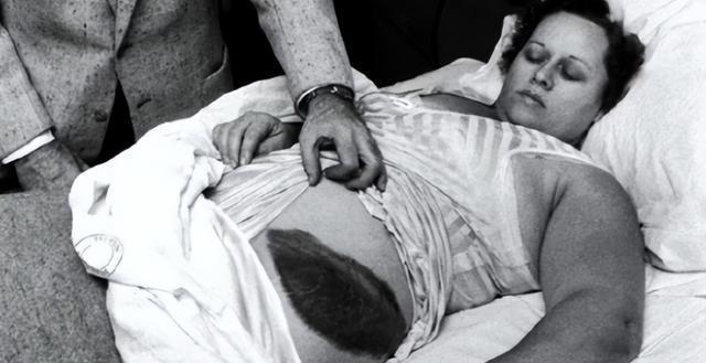 1954年，国外一女子正在睡觉中，突然感觉肚子被什么东西蹭着了一样，疼痛难忍，等