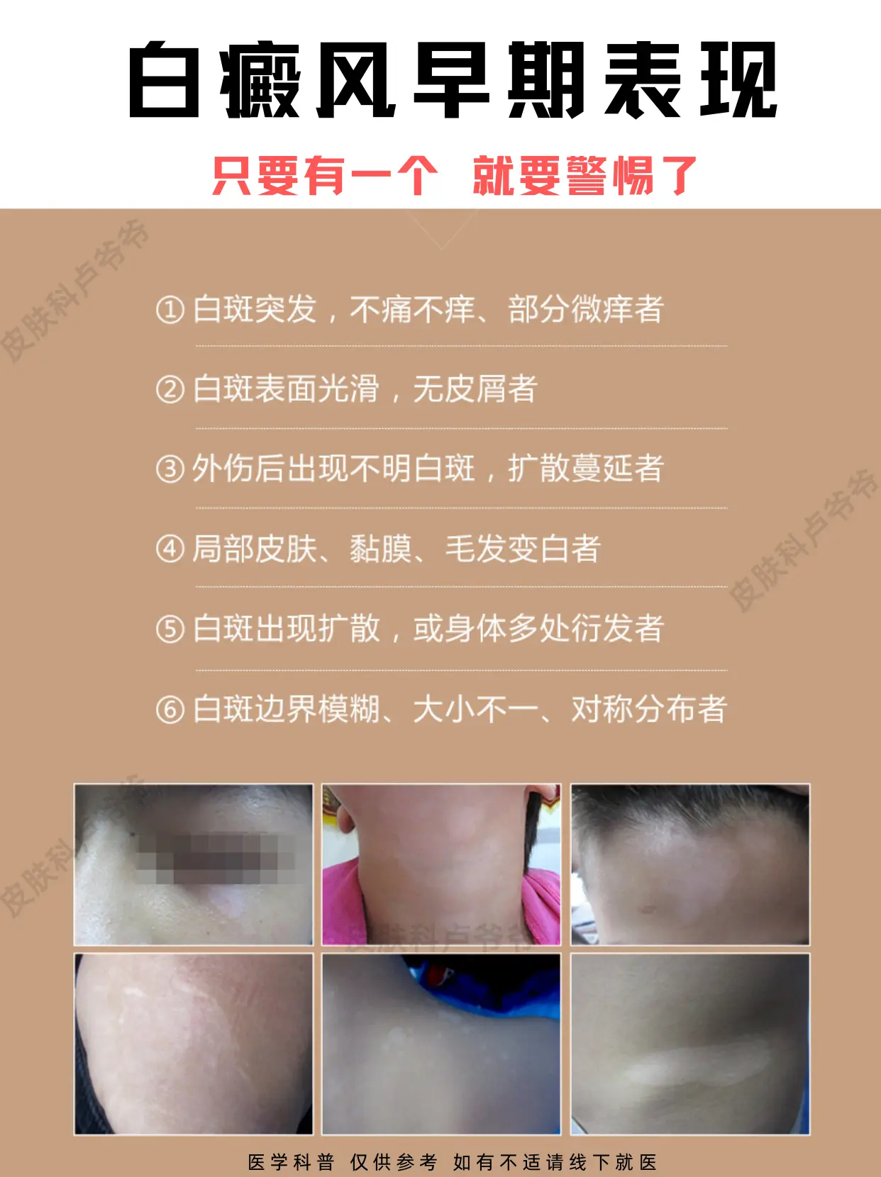 白癜风的早期表现，快来自查。