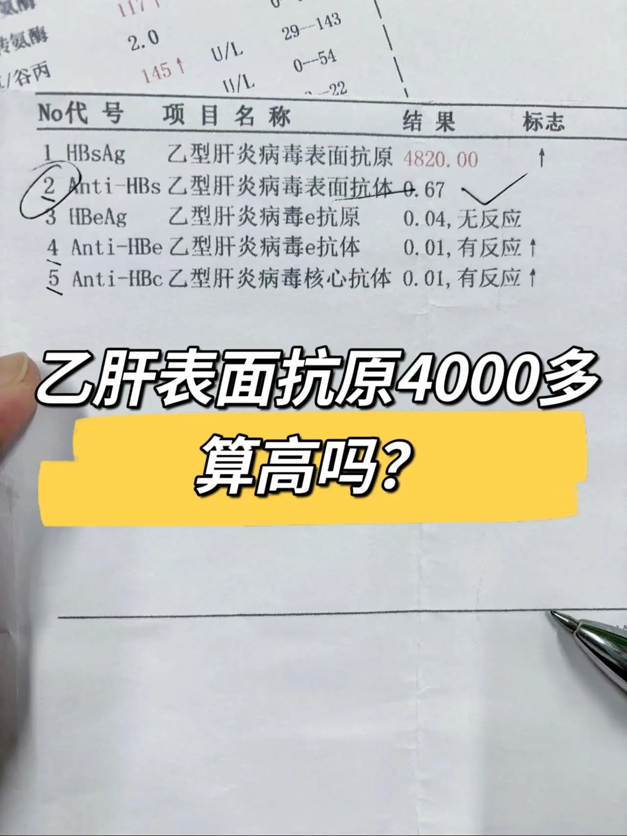 乙肝表面抗原4000多算高吗？表面抗原4000 多相对还是比较高的，不...