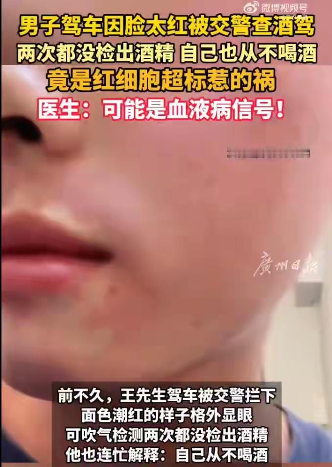 换谁遇上这事儿都得懵！交警同志见惯了酒后脸红的驾驶人，见王先生满脸通红，第一反应