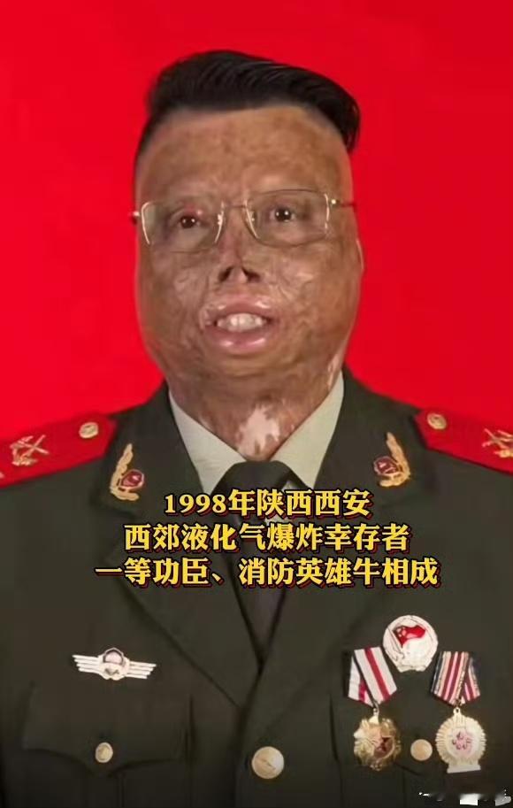 这样的面容你怕吗？致敬消防英雄牛相成! 舍身救人烧伤面积 达97%，立一等功！ 