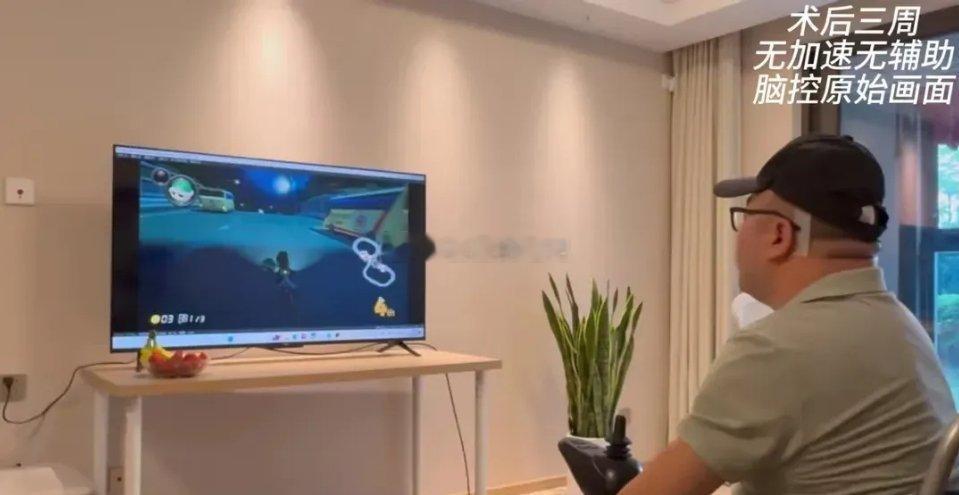 我国成功开展首例侵入式脑机接口临床试验！相关受益股会不会起飞！中科院和华山医院整