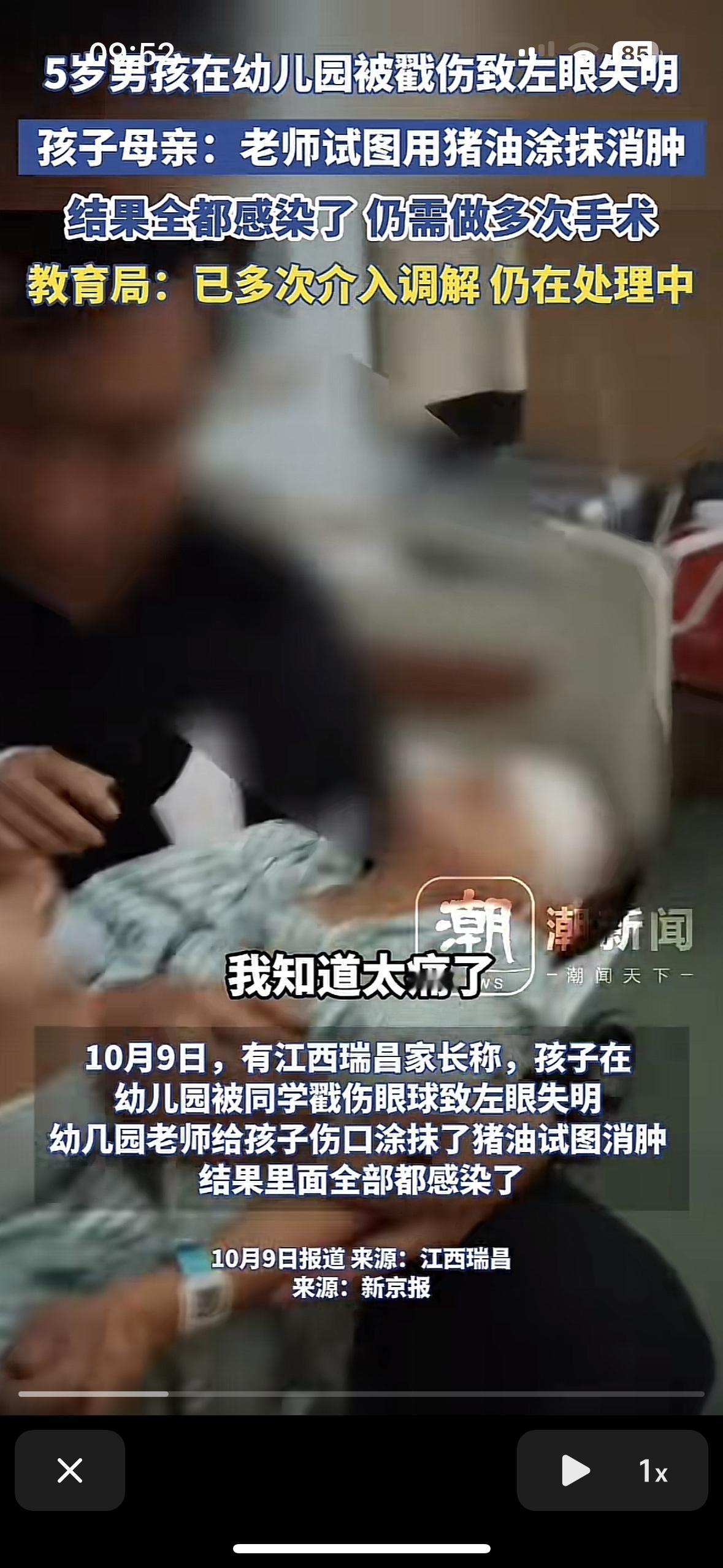 看着太让人心疼了！这么小就要承受这么大的痛苦，这是27万可以买来的吗？
5岁的孩