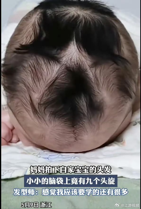 #医生称头旋数量不影响智商性格#【浙江宝宝“九个头旋”引热议，儿保医师：头旋数量