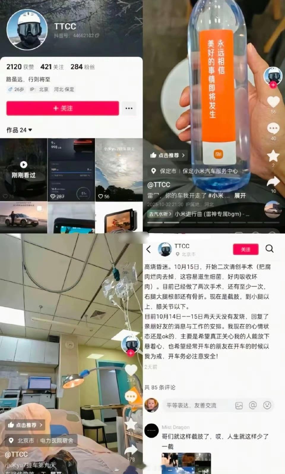 这个博主好惨，10月2号提的车15号就截肢了。 ​​​