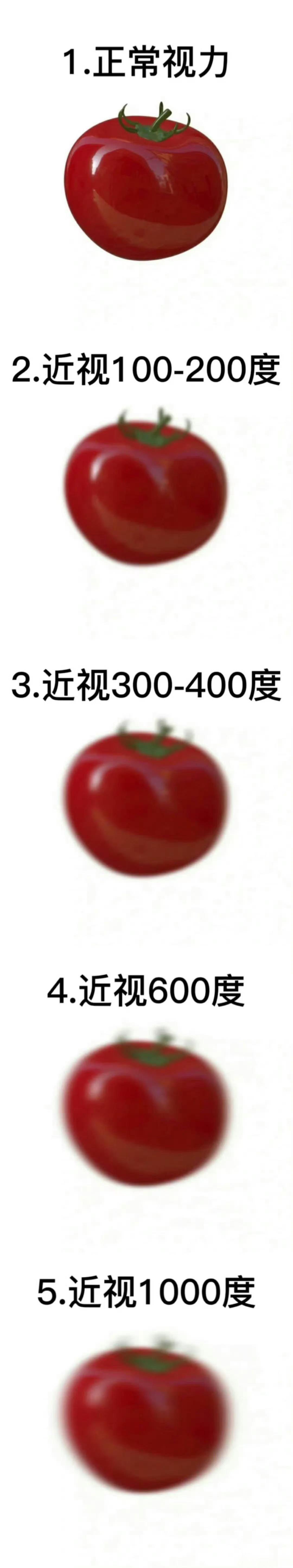 眼睛度数降了100度 还能降度数？我记得近视是不可逆的呀？ ​​​