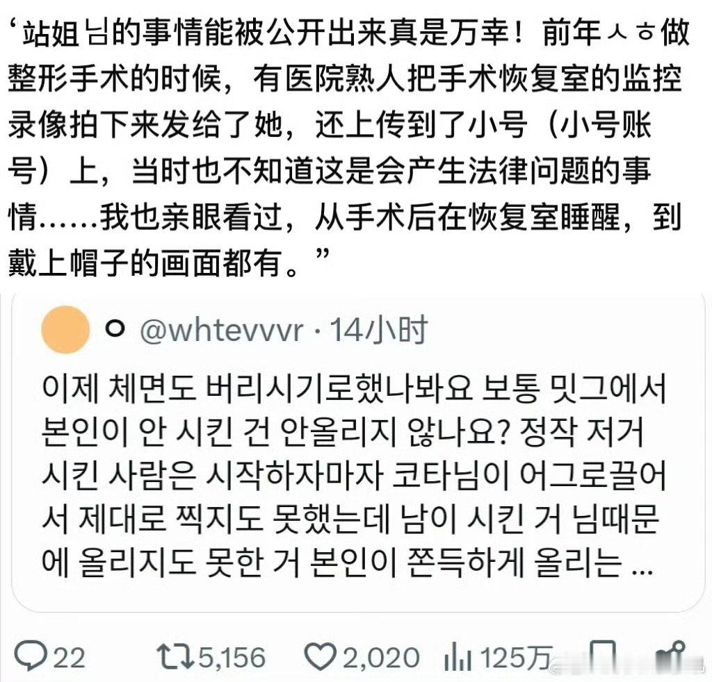 曝朴成训整容朴成训站姐爆料 曝朴成训整容，真的假的 