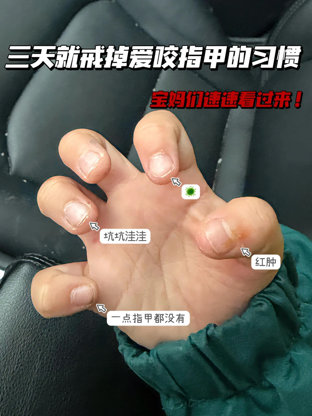 戒吃手的习惯，三天居然被我改掉了👍～
