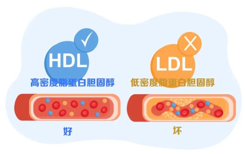 低密度脂蛋白要低于多少，斑块才能不发展？医生告诉你答案！

刘先生是一位50多岁