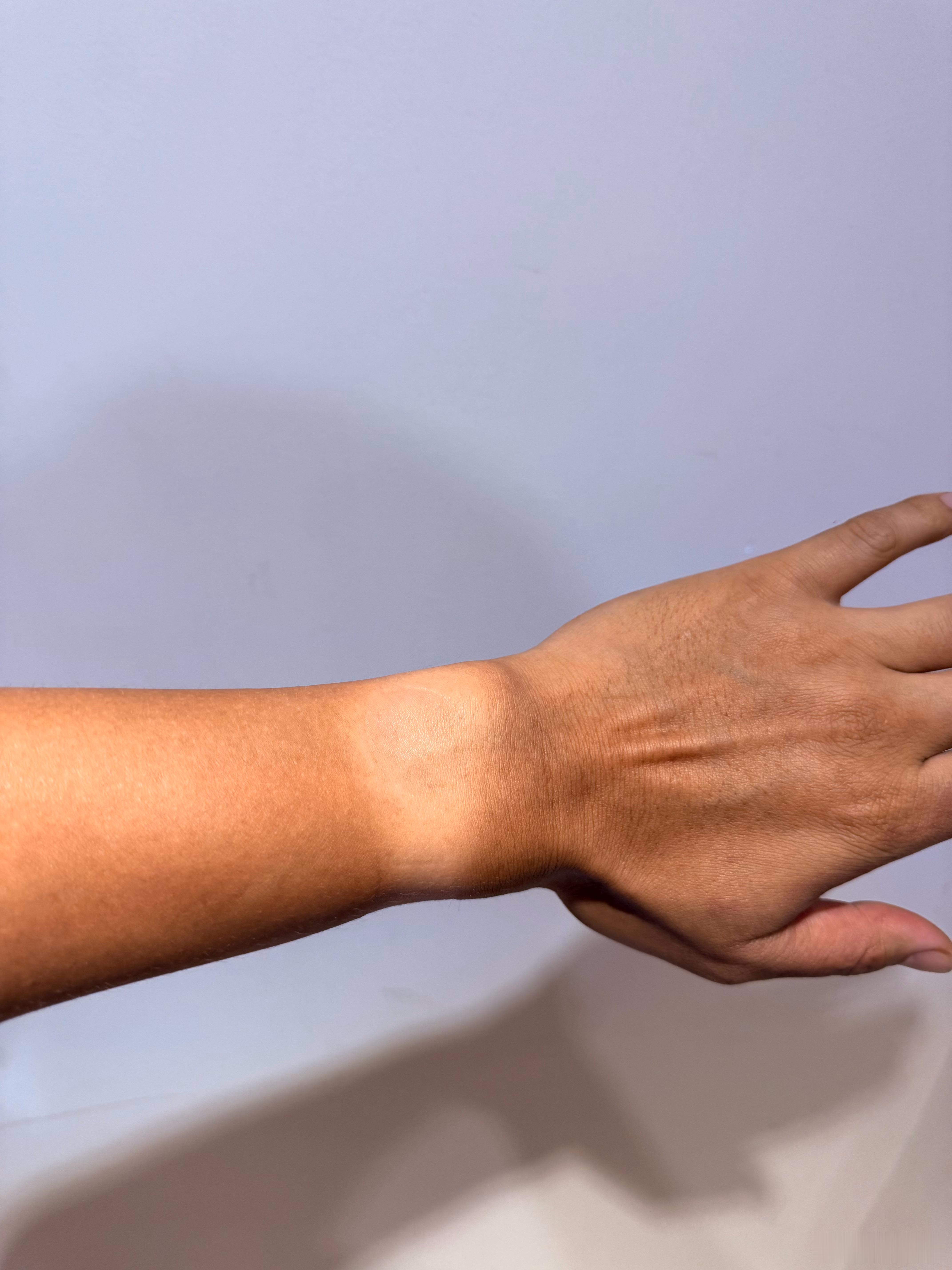 夏天到了跑者&体育老师的手臂 福州·福建农林大学(金山校区)